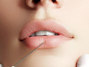 lip filler treatments